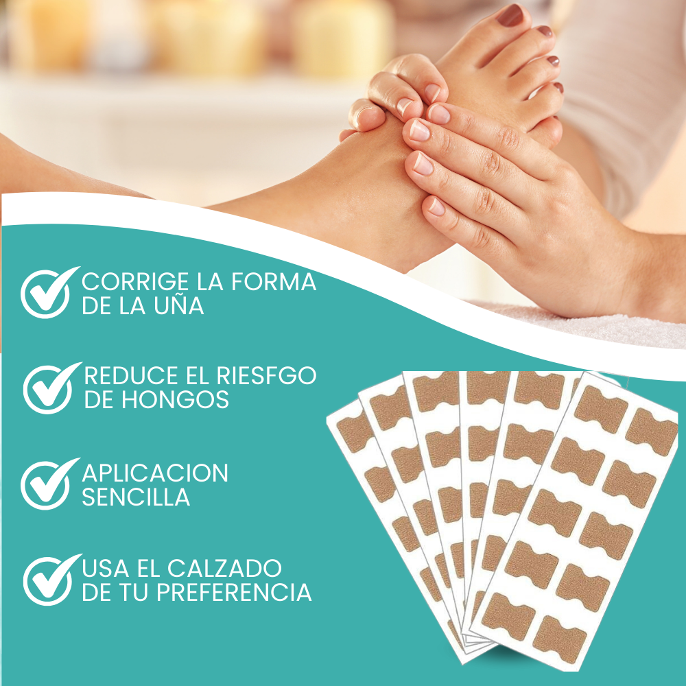 1+1 GRATIS UÑAFIX™ | REPARA LAS UÑAS ENCARNADAS SIN DOLOR